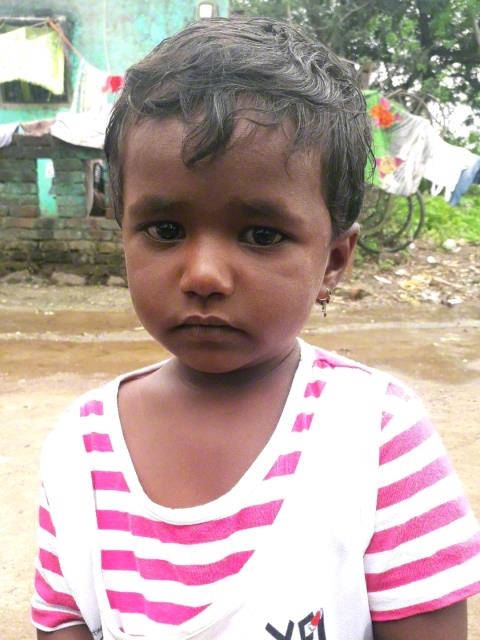 World Vision India